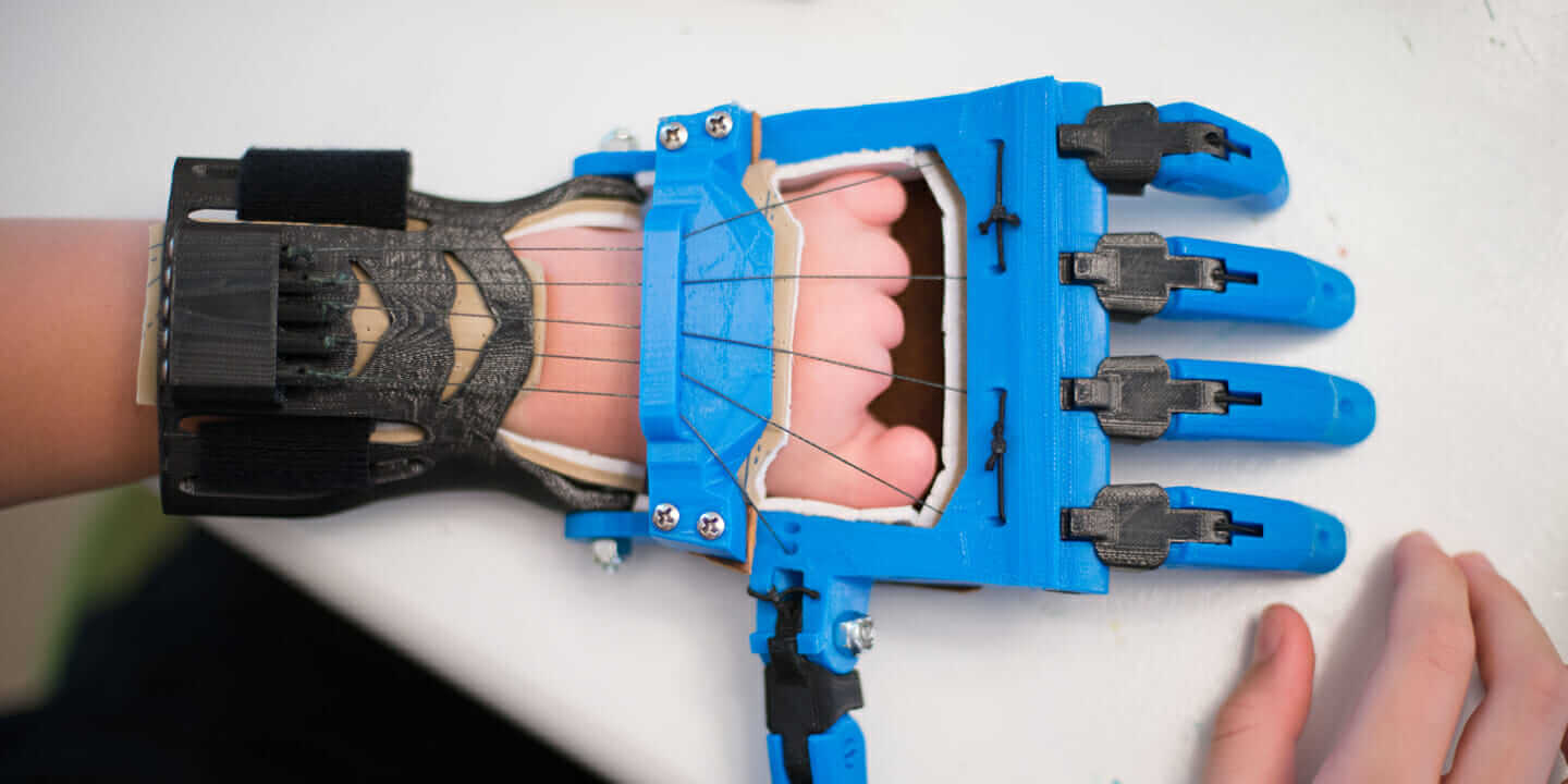 In What Ways Are 3d Prosthetics Changing Our Lives