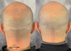 smp hair Mansfield Ohio